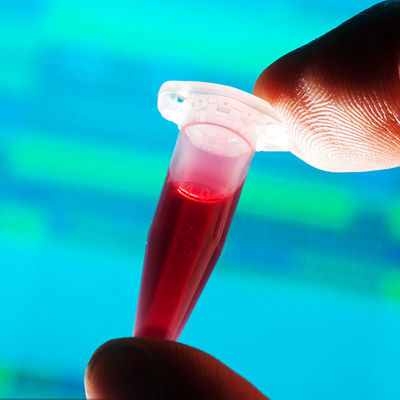 FDA-gebilligter aus dritter Quelleauthentisierungsservice der Testlaboratorium-schneller Entdeckungs-Nahrungsmittelkontakt-Baby-Flasche